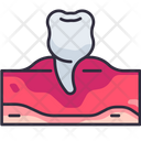 پیش‌نمایش فایل premolar-5008744 از پک دندان‌پزشکی