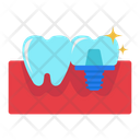 پیش‌نمایش فایل dental-implant-7846570 از پک مجموعه استیکر مراقبت از دندان