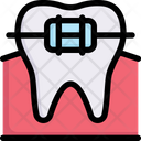 پیش‌نمایش فایل tooth-brace-2706859 از پک دندانپزشکی