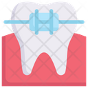 پیش‌نمایش فایل tooth-brace-2706909 از پک دندانپزشکی