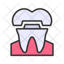 پیش‌نمایش فایل dental-crown-8583985 از پک مراقبت از دندان