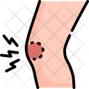 پیش‌نمایش فایل knee-injury-13255658 از پک نقرس