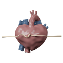 پیش‌نمایش فایل cardiac-arrest-8915404 از پک قلب و عروق