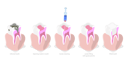 پیش‌نمایش فایل root-canal-treatment-8902616 از پک مجموعه موضوعات متنوع ۰۵۹