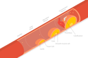 پیش‌نمایش فایل stage-of-atherosclerosis-8902970 از پک مجموعه موضوعات متنوع ۰۶۰