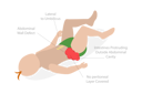 پیش‌نمایش فایل abdominal-pain-belly-button-8949062 از پک مجموعه موضوعات متنوع ۰۶۲