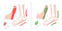 پیش‌نمایش فایل difference-between-sick-and-healthy-feet-8949037 از پک مجموعه موضوعات متنوع ۰۶۲