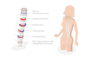 پیش‌نمایش فایل young-lady-suffering-with-degenerative-disc-disease-8947634 از پک مجموعه موضوعات متنوع ۰۶۱