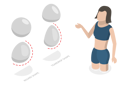 پیش‌نمایش فایل breast-implant-types-10009164 از پک مجموعه موضوعات متنوع ۰۷۹