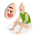 پیش‌نمایش فایل birthmark-stain-on-face-10730718 از پک مجموعه موضوعات متنوع ۱۱۲