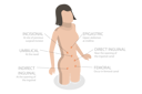 پیش‌نمایش فایل type-of-abdominal-hernias-10730719 از پک مجموعه موضوعات متنوع ۱۱۲