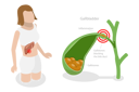 پیش‌نمایش فایل gallstone-disease-10851163 از پک مجموعه موضوعات متنوع ۱۲۱