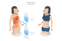 پیش‌نمایش فایل peritoneal-dialysis-10851683 از پک مجموعه موضوعات متنوع ۱۳۴