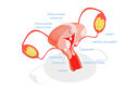 پیش‌نمایش فایل types-of-uterine-fibroids-10851678 از پک مجموعه موضوعات متنوع ۱۳۴