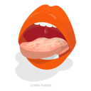 پیش‌نمایش فایل sore-or-white-tongue-11358087 از پک مجموعه موضوعات متنوع ۱۲۶