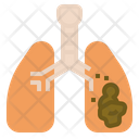 پیش‌نمایش فایل lung-cancer-1 از پک مجموعه آیکن تخت علائم پزشکی