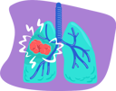 پیش‌نمایش فایل lung-cancer-5362320 از پک مراقبت‌های بهداشتی