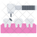 پیش‌نمایش فایل tooth-hole-5873292 از پک دندانپزشکی