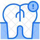 پیش‌نمایش فایل cracked-tooth-5873164 از پک دندانپزشکی