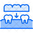 پیش‌نمایش فایل tooth-implant-5873197 از پک دندانپزشکی