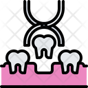 پیش‌نمایش فایل pulling-tooth-5873144 از پک دندانپزشکی