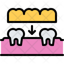 پیش‌نمایش فایل tooth-implant-5873147 از پک دندانپزشکی