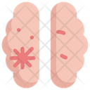 پیش‌نمایش فایل brain-cancer-1833132 از پک سرطان