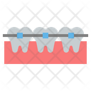 پیش‌نمایش فایل teeth-braces-4457030 از پک دندانپزشکی