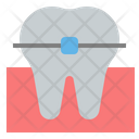 پیش‌نمایش فایل teeth-braces-4457042 از پک دندانپزشکی