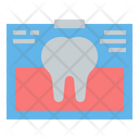 پیش‌نمایش فایل tooth-xray-4457022 از پک دندانپزشکی