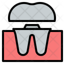 پیش‌نمایش فایل dental-crown-4456986 از پک دندانپزشکی