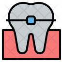 پیش‌نمایش فایل teeth-braces-4457012 از پک دندانپزشکی