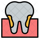 پیش‌نمایش فایل tooth-decayed-4457010 از پک دندانپزشکی