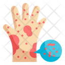 پیش‌نمایش فایل rash-allergy-4373576 از پک حساسیت ها