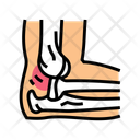 پیش‌نمایش فایل dislocated-joint-13429524 از پک شکستگی و آسیب استخوان