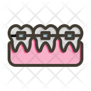 پیش‌نمایش فایل braces-9955842 از پک مراقبت از دندان