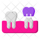 پیش‌نمایش فایل dental-crown-1664752 از پک دندانپزشکی