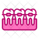 پیش‌نمایش فایل braces-1664724 از پک دندانپزشکی