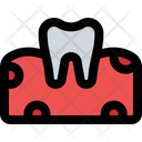 پیش‌نمایش فایل tooth-on-gum-5153754 از پک دندان‌پزشکی