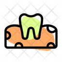 پیش‌نمایش فایل tooth-on-gum-5153914 از پک دندان‌پزشکی