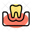 پیش‌نمایش فایل tooth-on-gum-two-5153915 از پک دندان‌پزشکی