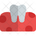 پیش‌نمایش فایل tooth-on-gum-5153993 از پک دندان‌پزشکی
