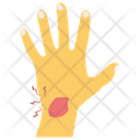 پیش‌نمایش فایل hand-bleeding-1423001 از پک اندام‌های بدن و آسیب‌های فیزیکی