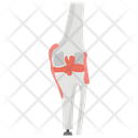 پیش‌نمایش فایل artificial-human-knee-1447197 از پک پروتز ارتوپدی، ایمپلنت‌های پزشکی و اندام‌های مصنوعی
