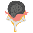 پیش‌نمایش فایل brain-with-spinal-1447185 از پک پروتز ارتوپدی، ایمپلنت‌های پزشکی و اندام‌های مصنوعی