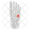 پیش‌نمایش فایل foot-fracture-1447134 از پک پروتز ارتوپدی، ایمپلنت‌های پزشکی و اندام‌های مصنوعی