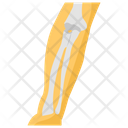 پیش‌نمایش فایل forearm-fracture-1447135 از پک پروتز ارتوپدی، ایمپلنت‌های پزشکی و اندام‌های مصنوعی