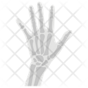 پیش‌نمایش فایل hand-x-ray-1447172 از پک پروتز ارتوپدی، ایمپلنت‌های پزشکی و اندام‌های مصنوعی