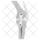 پیش‌نمایش فایل knee-joints-1447168 از پک پروتز ارتوپدی، ایمپلنت‌های پزشکی و اندام‌های مصنوعی