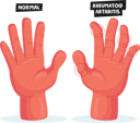 پیش‌نمایش فایل finger-joints-inflammation-medical-healthcare-4704756 از پک سلامت و پزشکی
